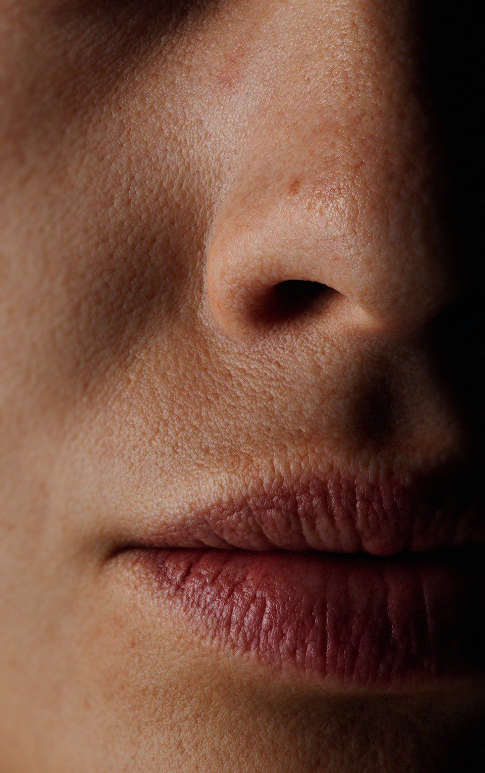 PELLE SECCA & DISIDRATATA